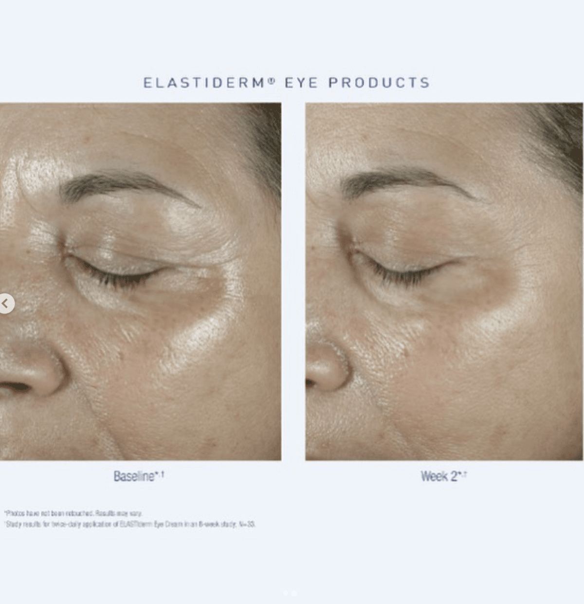 The 5 Best Obagi Products To Get Back Your Baby Skin Haul of Fame